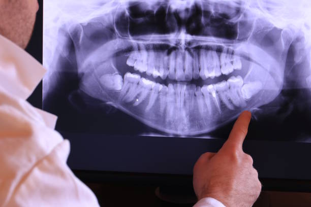 Best Same-Day Emergency Dentist in Burlington, ND