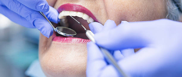 Best Emergency Wisdom Teeth Removal in Burlington, ND